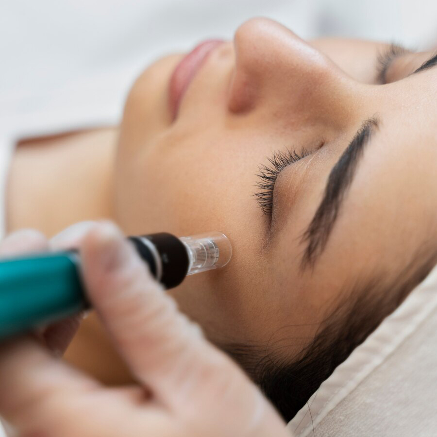 11 Microneedling full 11 Microneedling full